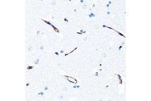 Immunohistochemistry (IHC) image for anti-ATP-Binding Cassette, Sub-Family B (MDR/TAP), Member 1 (ABCB1) antibody (ABIN7265732)