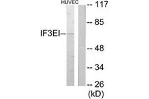 Western Blotting (WB) image for anti-Eukaryotic Translation Initiation Factor 3, Subunit L (EIF3L) (AA 1-50) antibody (ABIN2889816) (EIF3L Antikörper  (AA 1-50))