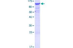 Image no. 1 for Thyroid Hormone Receptor Interactor 10 (TRIP10) (AA 1-545) protein (GST tag) (ABIN1323770) (TRIP10 Protein (AA 1-545) (GST tag))