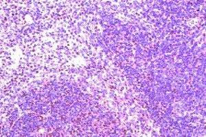 Immunohistochemistry (IHC) image for anti-Chemokine (C-C Motif) Receptor 8 (CCR8) antibody (ABIN2472921)