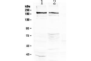 Western blot analysis of Neurocan using anti-Neurocan antibody . (Neurocan Antikörper)