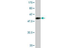 Western Blot detection against Immunogen (51. (TGIF2 Antikörper  (AA 1-237))