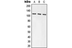 Western blot analysis of Axin-1 expression in HEK293T (A), NIH3T3 (B), PC12 (C) whole cell lysates. (Axin Antikörper  (Center))