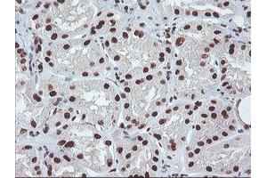 Immunohistochemical staining of paraffin-embedded Human Kidney tissue using anti-EXOSC7 mouse monoclonal antibody. (EXOSC7 Antikörper)