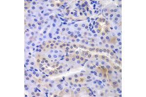 Immunohistochemistry of paraffin-embedded mouse kidney using PSMA6 antibody at dilution of 1:100 (400x lens).