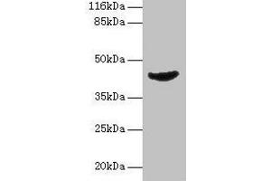 Western blot All lanes: ADA antibody at 2 μg/mL + Jurkat whole cell lysate Secondary Goat polyclonal to rabbit IgG at 1/10000 dilution Predicted band size: 41 kDa Observed band size: 41 kDa (ADA Antikörper  (AA 157-343))