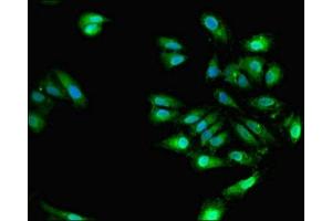 Immunofluorescent analysis of Hela cells using ABIN7151487 at dilution of 1:100 and Alexa Fluor 488-congugated AffiniPure Goat Anti-Rabbit IgG(H+L) (ELAVL4 Antikörper  (AA 1-150))