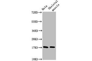 Western Blot Positive WB detected in: Hela whole cell lysate, Rat skeletal muscle tissue All lanes: UBE2D3 antibody at 4. (UBE2D3 Antikörper  (AA 1-147))