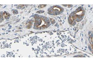 ABIN6274956 at 1/100 staining Human prostate tissue by IHC-P. (CA1 Antikörper  (Internal Region))
