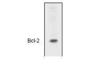 Image no. 1 for anti-B-Cell CLL/lymphoma 2 (BCL2) (N-Term) antibody (ABIN126981) (Bcl-2 Antikörper  (N-Term))