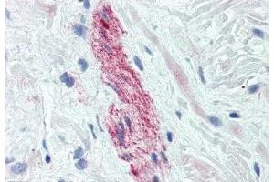 Image no. 3 for anti-Nestin (NES) antibody (ABIN108568) (Nestin Antikörper)