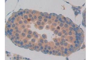 Detection of CCL6 in Rat Testis Tissue using Polyclonal Antibody to Chemokine (C-C motif) ligand 6 (CCL6) (CCL6 Antikörper  (AA 21-115))