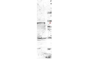 Western blot using  affinity purified anti-Nedd4 antibody shows detection of a 115 kDa band corresponding to endogenous Nedd4 (arrowhead) in MDA-MB-435S cell lysates.