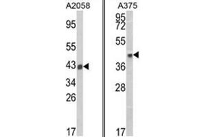 (LEFT) Western blot analysis of HLA-B Antibody (N-term) in A2058 cell line lysates (35ug/lane).