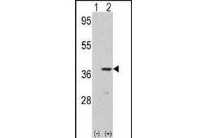 Western blot analysis of CDK3(arrow) using rabbit polyclonal CDK3 Antibody (N-term Y19) . (CDK3 Antikörper  (N-Term))