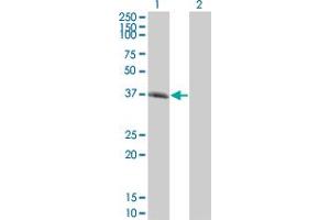 Western Blot analysis of SPI1 expression in transfected 293T cell line by SPI1 monoclonal antibody (M01), clone 1A3. (SPI1 Antikörper  (AA 1-120))