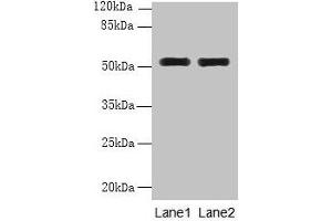 Western blot All lanes: WDR88 antibody at 6 μg/mL Lane 1: MCF-7 whole cell lysate Lane 2: A549 whole cell lysate Secondary Goat polyclonal to rabbit IgG at 1/10000 dilution Predicted band size: 53, 48 kDa Observed band size: 53 kDa (WDR88 Antikörper  (AA 1-250))