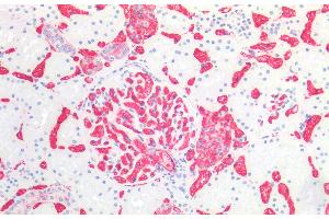 Immunohistochemistry staining of human kidney (paraffin-embedded sections) with anti-blood group A (HE-193), dilution 1:50. (ABO, Blood Group A Antigen Antikörper)