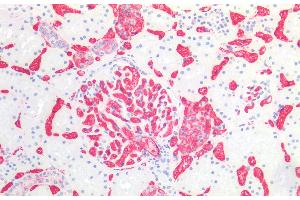 Immunohistochemistry staining of human kidney (paraffin-embedded sections) with anti-blood group A (HE-193), dilution 1:50.