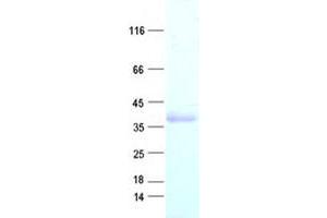 Western Blotting (WB) image for Ring Finger Protein 41 (RNF41) protein (His tag) (ABIN2731047)