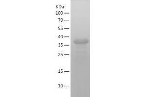 Synaptophysin Protein (SYP) (AA 217-313) (His-IF2DI Tag)