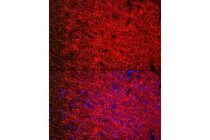 Immunofluorescence analysis of mouse brain cells using [KO Validated] βIII-Tubulin Mouse mAb  at dilution of 1:200 (40x lens). (TUBB3 Antikörper)
