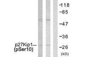 Western blot analysis of extracts from A2780 and COLO205 cells, using p27 Kip1 (Phospho-Ser10) Antibody. (CDKN1B Antikörper  (pSer10))
