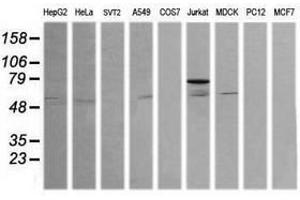 Image no. 4 for anti-ERG, ETS transcription factor (ERG) antibody (ABIN1498075) (ERG Antikörper)