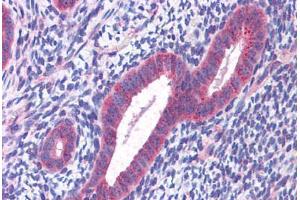 Human Uterus: Formalin-Fixed, Paraffin-Embedded (FFPE) (CCDC106 Antikörper  (C-Term))