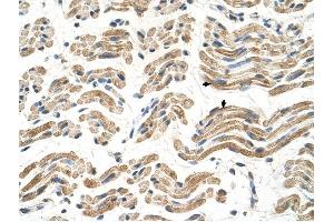 ALDH4A1 antibody was used for immunohistochemistry at a concentration of 4-8 ug/ml to stain Skeletal muscle cells (arrows) in Human Muscle. (ALDH4A1 Antikörper  (C-Term))