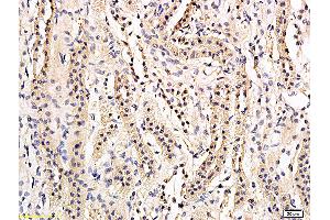 Formalin-fixed and paraffin embedded rat kidney labeled with Anti-phospho-AQP2(Ser269) Polyclonal Antibody, Unconjugated (ABIN756127) followed by conjugation to the secondary antibody and DAB staining (AQP2 Antikörper  (pSer269))