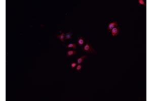 ABIN6268941 staining A549 cells by IF/ICC. (HNF1B Antikörper  (Internal Region))