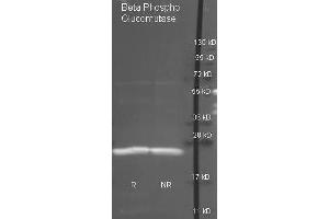 Goat anti antibody ( was used to detect purified Beta Phospho Glucomutase under reducing (R) and non-reducing (NR) conditions. (Beta-Phosphoglucomutase Antikörper  (HRP))