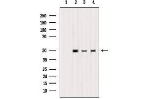 Western blot analysis of extracts from various samples, using K1H2 Antibody.