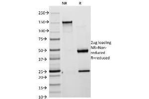 SDS-PAGE Analysis of Purified Cytokeratin 18 Mouse Monoclonal Antibody (KRT18/835). (KRT8, KRT18 Antikörper)