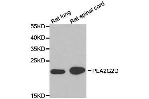 Western blot analysis of extracts of rat lung and rat spinal cord cell lines, using PLA2G2D antibody. (PLA2G2D Antikörper)