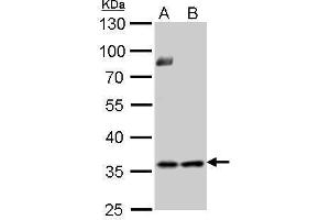WB Image Thymidylate synthetase antibody detects TYMS protein by Western blot analysis.