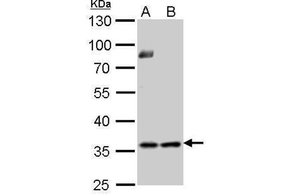 TYMS antibody