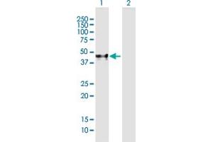 Western Blot analysis of ACPP expression in transfected 293T cell line by ACPP MaxPab polyclonal antibody. (ACPP Antikörper  (AA 1-386))