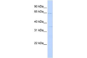 WB Suggested Anti-RORA Antibody Titration:  0. (RORA Antikörper  (N-Term))