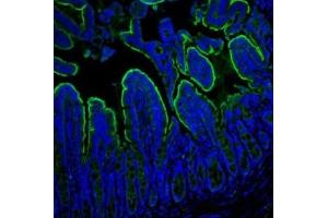 IF analysis of Villin using anti-Villin antibody (ABIN3042343). (Villin 1 Antikörper  (C-Term))
