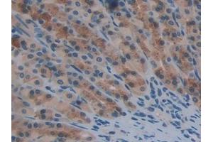 Detection of TXNRD1 in Rat Stomach Tissue using Polyclonal Antibody to Thioredoxin Reductase 1 (TXNRD1) (TXNRD1 Antikörper  (AA 208-433))