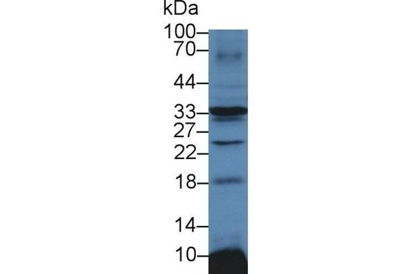 ATP1B3 anticorps  (AA 61-277)