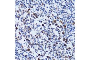 Immunohistochemistry of paraffin-embedded human tonsil using UHRF1 antibody. (UHRF1 Antikörper  (AA 1-260))
