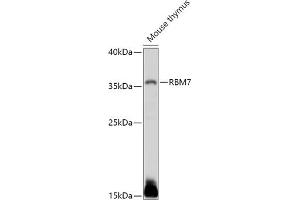 Western blot analysis of extracts of Mouse thymus, using RBM7 antibody (ABIN7270088) at 1:1000 dilution. (RBM7 Antikörper  (AA 1-266))