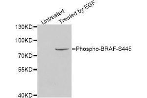 Western Blotting (WB) image for anti-B-Raf proto-oncogene, serine/threonine kinase (BRAF) (pSer445) antibody (ABIN3019432) (BRAF Antikörper  (pSer445))