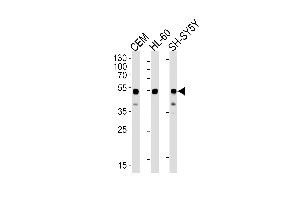 Western blot analysis of lysates from CEM, HL-60, SH-SY5Y cell lines (from left to right) using GATA3 Antibody (Center) (ABIN1944795 and ABIN2838499).