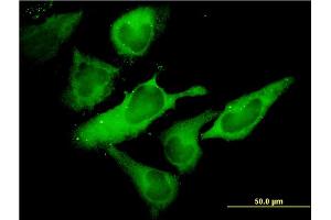 Immunofluorescence of monoclonal antibody to EIF2S1 on HeLa cell. (EIF2S1 Antikörper  (AA 1-315))