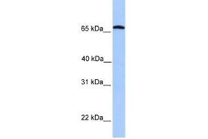 Calicin antibody used at 1 ug/ml to detect target protein. (Calicin Antikörper  (C-Term))