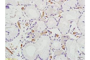 Formalin-fixed and paraffin embedded human colon tissue labeled with Anti Prominin2 Polyclonal Antibody, Unconjugated  at 1:200 followed by conjugation to the secondary antibody and DAB staining